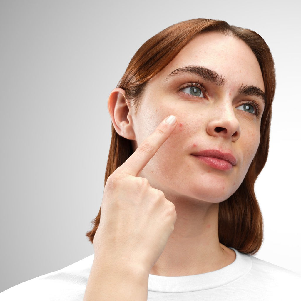 the-ordinary-sulfur-10-powder-to-cream-concentrate-02